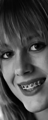 Perfect orthodontic Smile